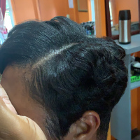 Hair