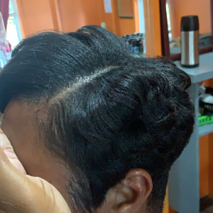 Hair